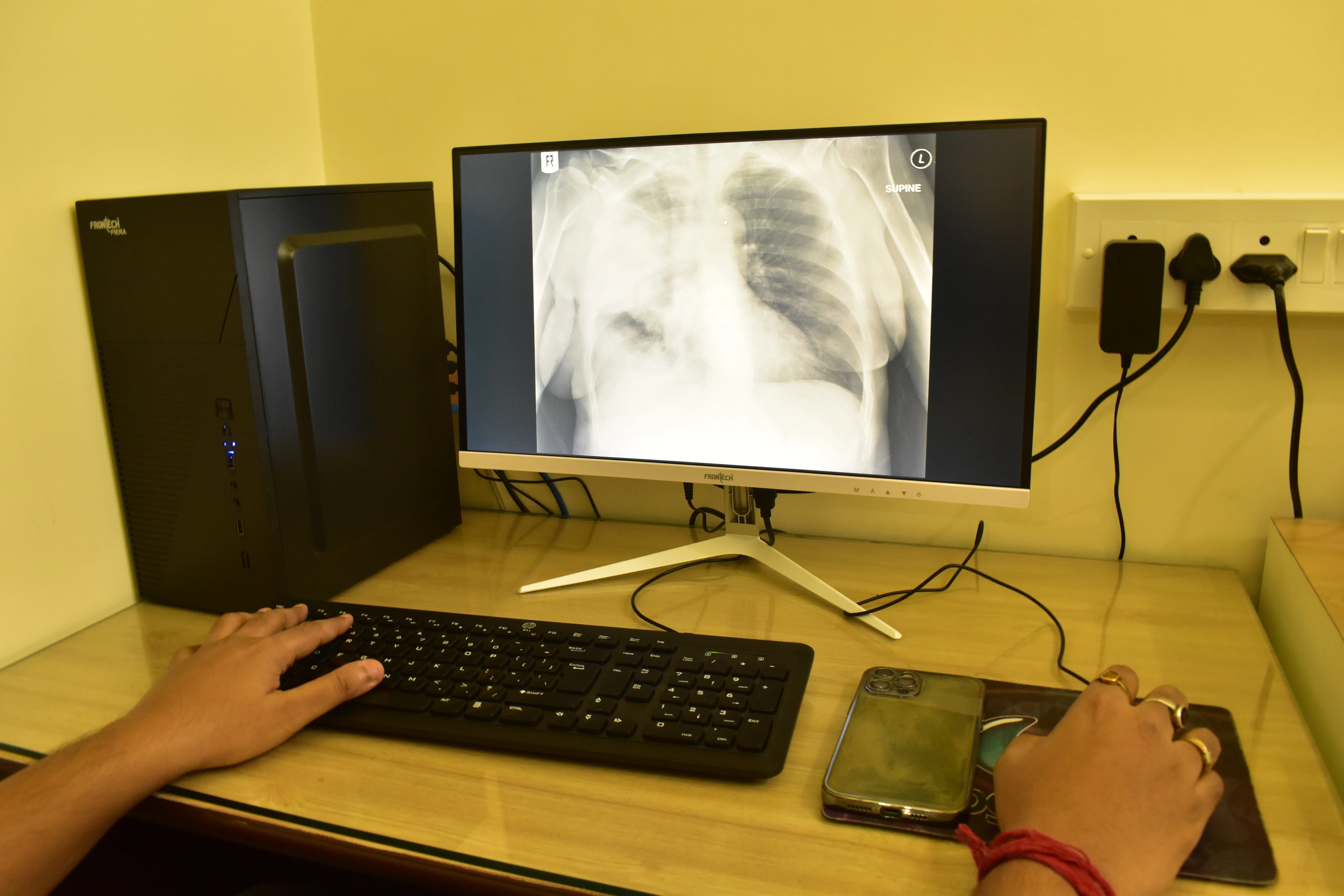 Digital X-Ray at Hetu Clinic