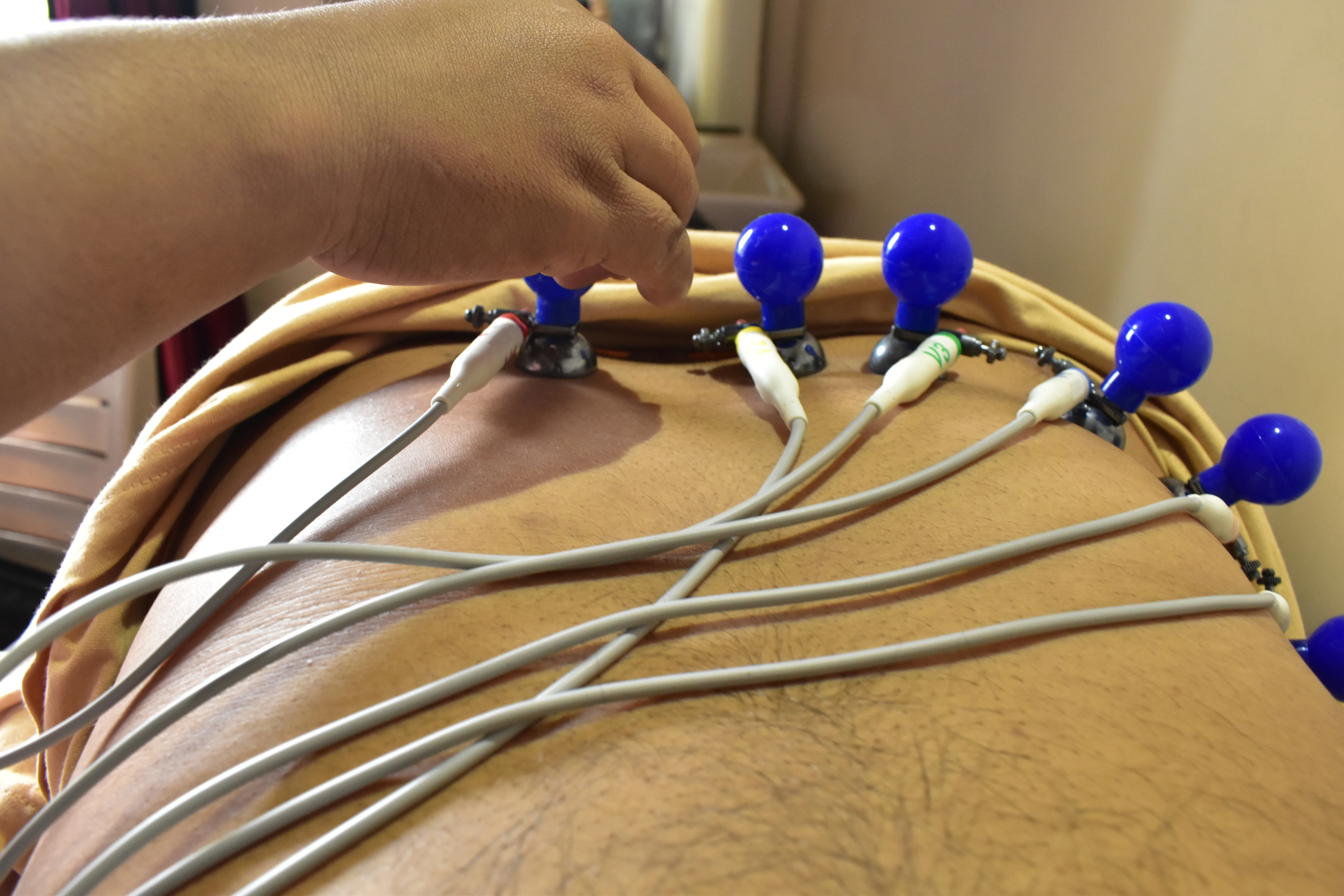 ECG at Hetu Clinic